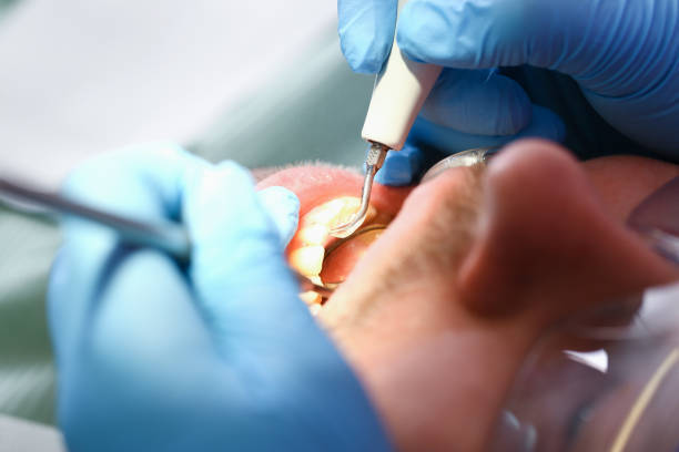 Best Walk-In Emergency Dental Services in Enetai, WA